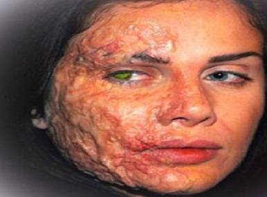 !!تشوّه وجه نيكول سابا